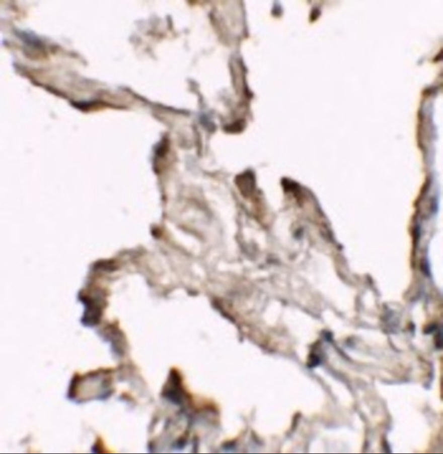 Immunohistochemistry of NIBRIN (CT) in human lung tissue with NIBRIN (CT) antibody at 2.5 μg/mL. Immunohistochemistry of NIBRIN (CT) in human lung tissue with NIBRIN (CT) antibody at 2.5 μg/mL.