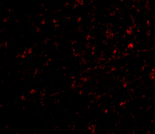Immunofluorescence of nipsnap in human brain tissue with nipsnap antibody at 20 μg/mL. Immunofluorescence of nipsnap in human brain tissue with nipsnap antibody at 20 μg/mL.