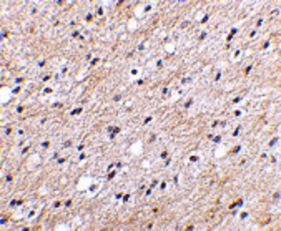 Immunohistochemical staining of human brain tissue using Nipsnap antibody at 2.5 μg/mL. Immunohistochemical staining of human brain tissue using Nipsnap antibody at 2.5 μg/mL.