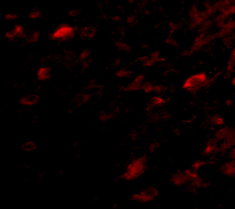 Immunofluorescence of NIPSNAP3A in Mouse Brain cells with NIPSNAP3A antibody at 5 μg/mL. Immunofluorescence of NIPSNAP3A in Mouse Brain cells with NIPSNAP3A antibody at 5 μg/mL.