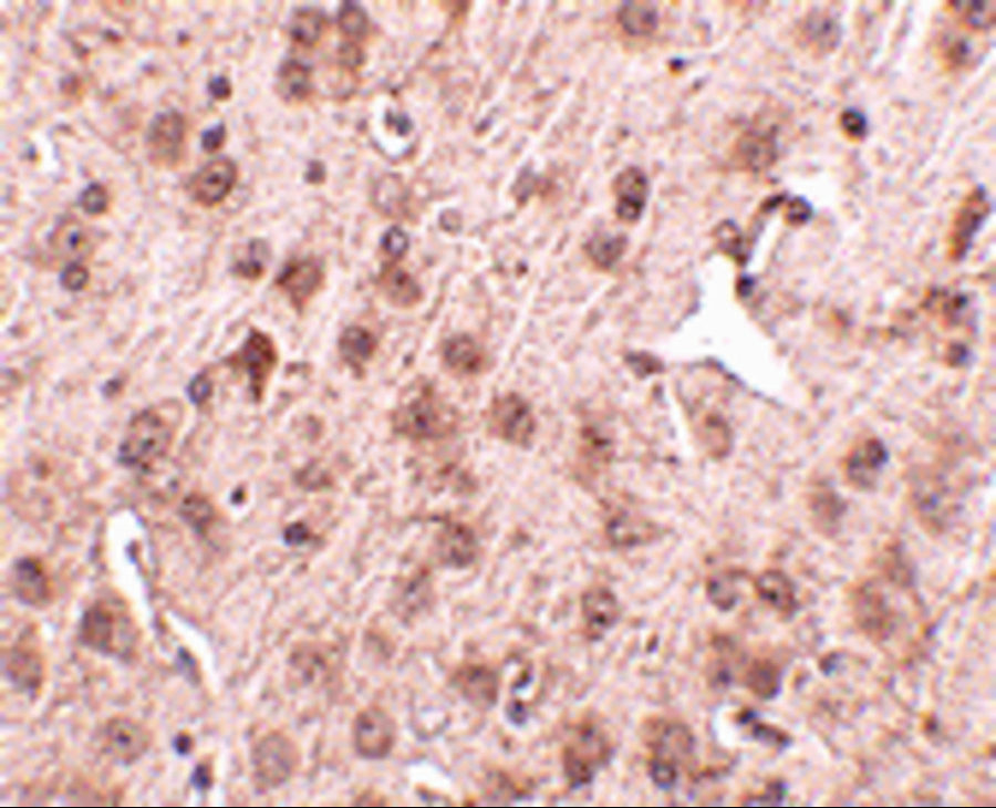 Immunohistochemistry of NIPSNAP3A in mouse brain tissue with NIPSNAP3A antibody at 2.5 μg/mL. Immunohistochemistry of NIPSNAP3A in mouse brain tissue with NIPSNAP3A antibody at 2.5 μg/mL.