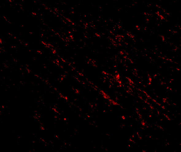 Immunofluorescence of nanos1 in human brain tissue with nanos1 antibody at 20 μg/mL. Immunofluorescence of nanos1 in human brain tissue with nanos1 antibody at 20 μg/mL.