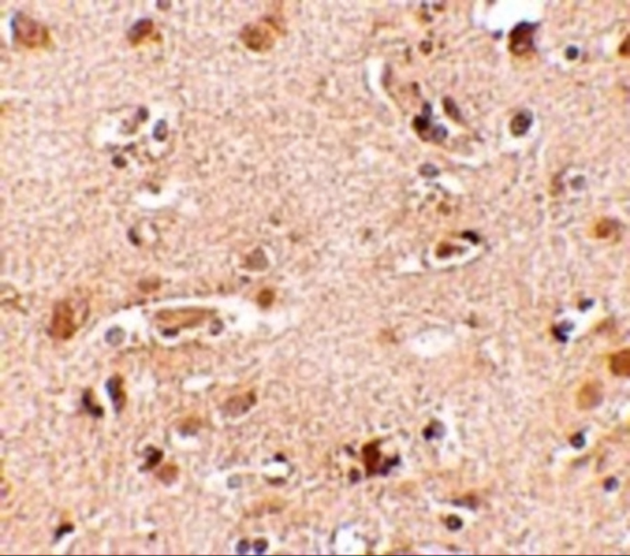 Immunohistochemistry of Nanos2 in human brain tissue cells with Nanos2 antibody at 2.5 μg/mL. Immunohistochemistry of Nanos2 in human brain tissue cells with Nanos2 antibody at 2.5 μg/mL.