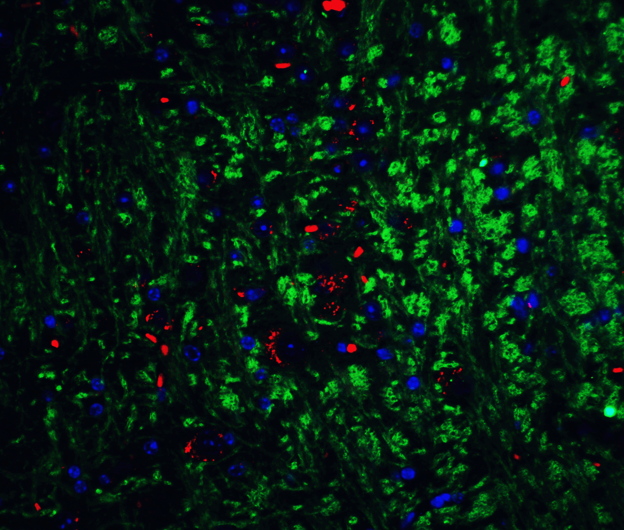 Immunofluorescence of Neurturin in mouse brain tissue with Neurturin Antibody at 20 μg/mL.<br><br>Green: Neuriturin Antibody (1121) <br> Red: Phylloidin staining<br> Blue: DAPI staining Immunofluorescence of Neurturin in mouse brain tissue with Neurturin Antibody at 20 μg/mL.<br><br>Green: Neuriturin Antibody (1121) <br> Red: Phylloidin staining<br> Blue: DAPI staining