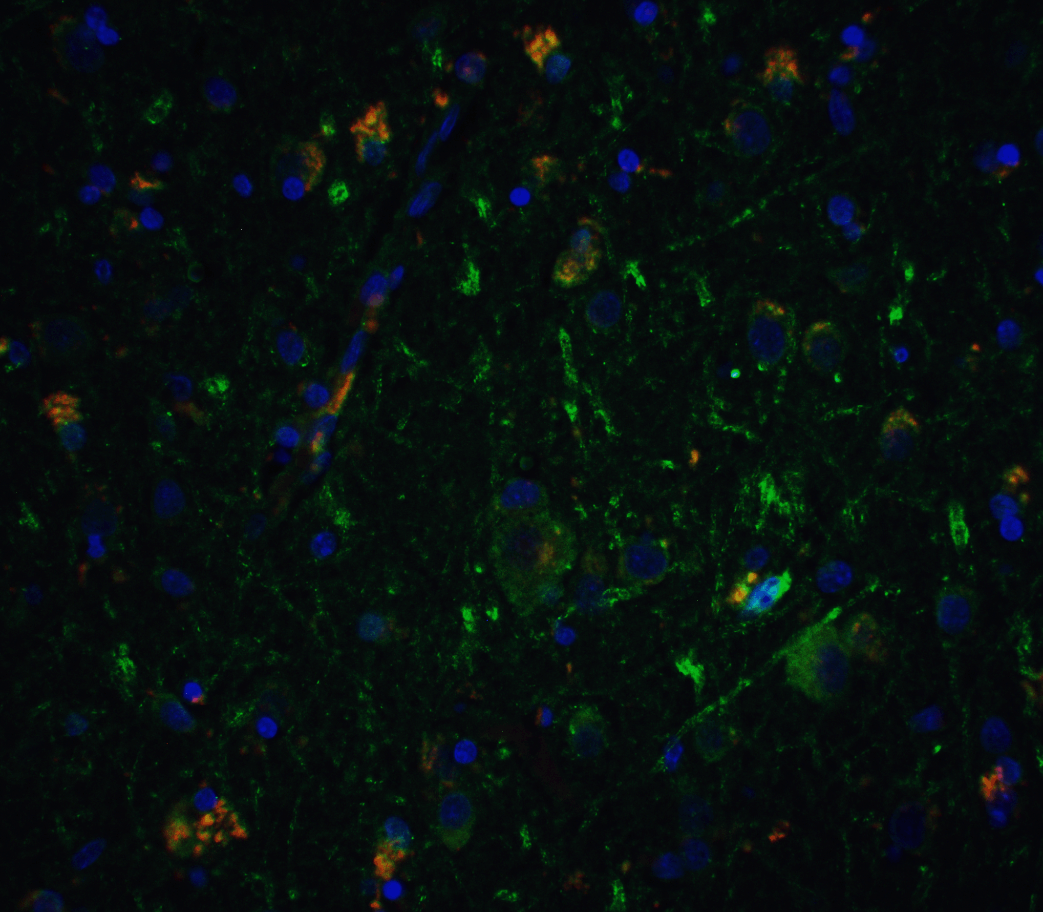 Immunofluorescence of Neurturin in human brain tissue with Neurturin antibody at 5 μg/ml.<br><br>Green: Neuriturin Antibody (1121) <br> Red: Phylloidin staining<br> Blue: DAPI staining Immunofluorescence of Neurturin in human brain tissue with Neurturin antibody at 5 μg/ml.<br><br>Green: Neuriturin Antibody (1121) <br> Red: Phylloidin staining<br> Blue: DAPI staining