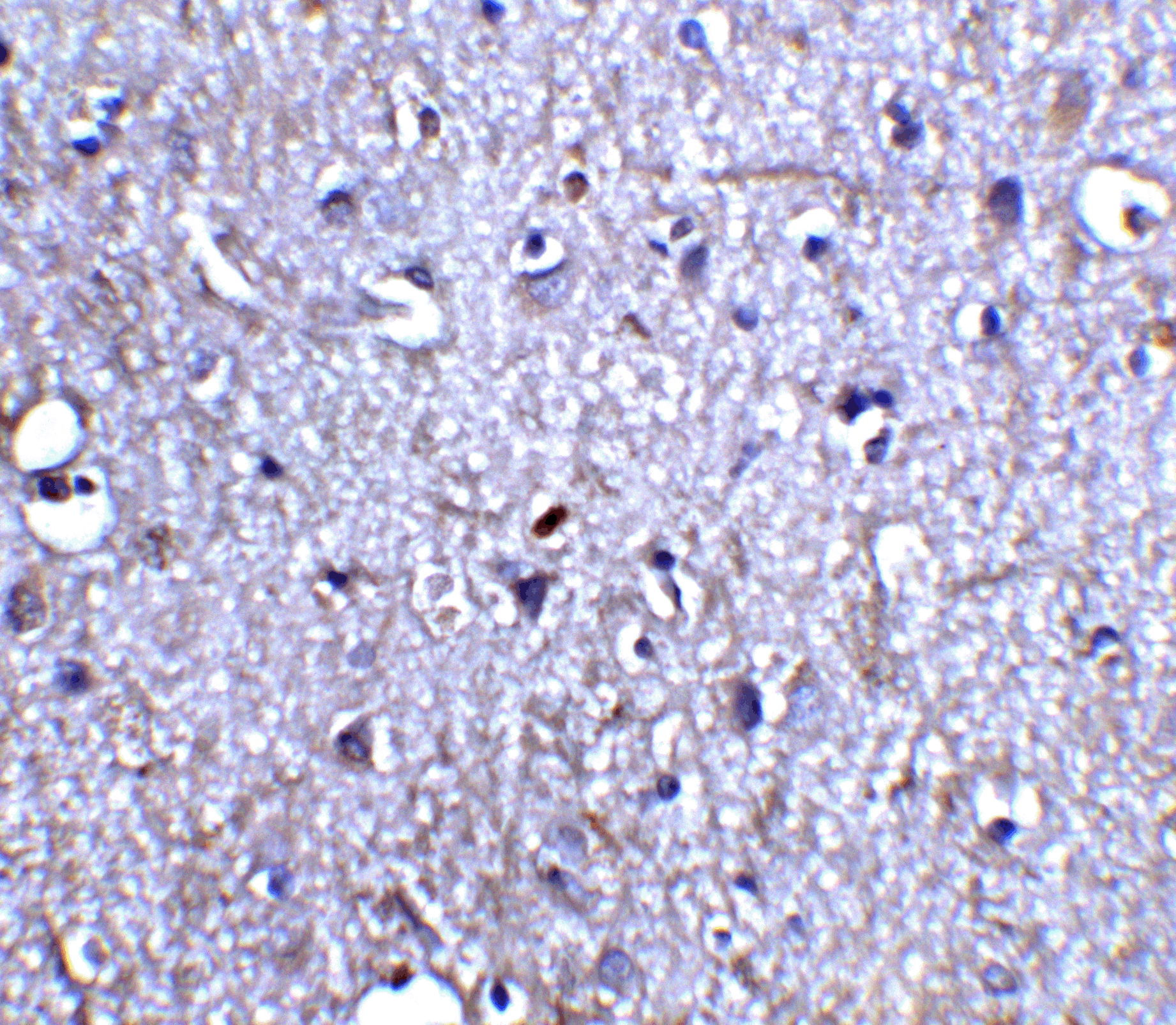Immunohistochemistry of Neurturin in human brain tissue with Neurturin antibody at 5 μg/ml. Immunohistochemistry of Neurturin in human brain tissue with Neurturin antibody at 5 μg/ml.