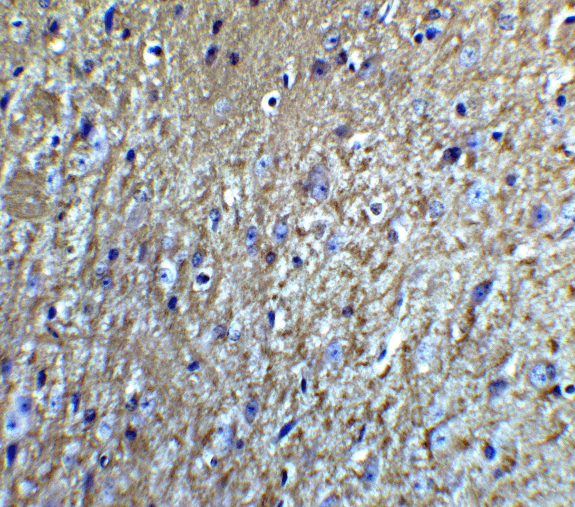 Immunohistochemistry of Neurturin in mouse brain tissue with Neurturin Antibody at 5 μg/mL. Immunohistochemistry of Neurturin in mouse brain tissue with Neurturin Antibody at 5 μg/mL.