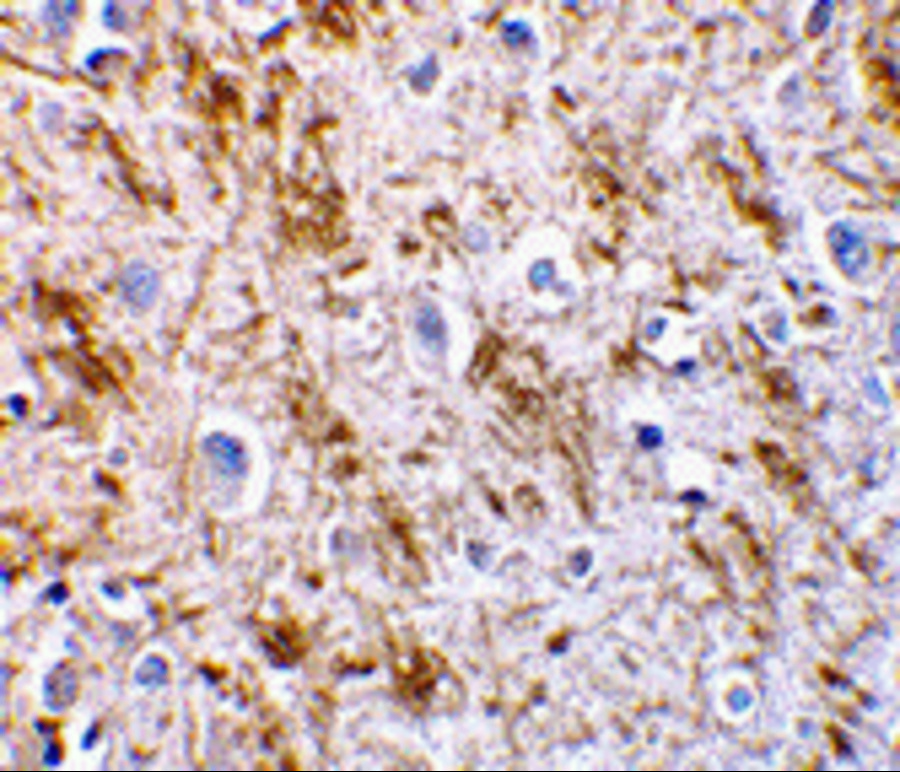 Immunohistochemistry of neurturin in human brain tissue with neurturin antibody at 5 μg/mL. Immunohistochemistry of neurturin in human brain tissue with neurturin antibody at 5 μg/mL.