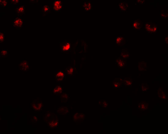Immunofluorescence of OCIAD2 in A549 cells with OCIAD2 antibody at 5 μg/mL. Immunofluorescence of OCIAD2 in A549 cells with OCIAD2 antibody at 5 μg/mL.