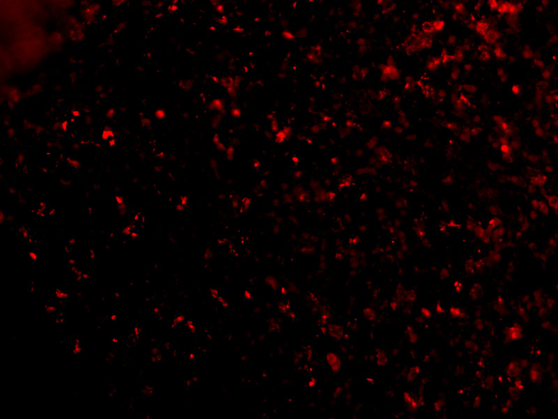 Immunofluorescence of ORAI1 in Human Spleen cells with ORAI1 antibody at 20 μg/mL. Immunofluorescence of ORAI1 in Human Spleen cells with ORAI1 antibody at 20 μg/mL.