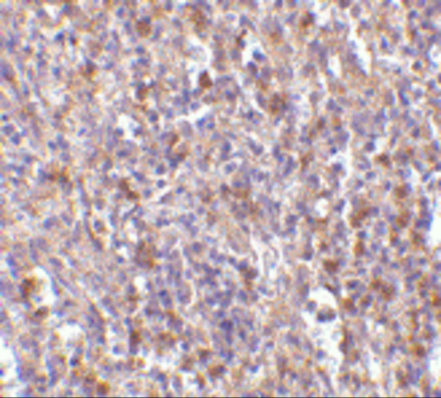 Immunohistochemistry of ORAI1 in human spleen tissue with ORAI1 antibody at 10 μg/mL. Immunohistochemistry of ORAI1 in human spleen tissue with ORAI1 antibody at 10 μg/mL.
