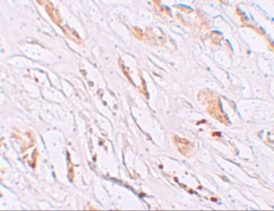 Immunohistochemistry of PEAR1 in human kidney tissue with PEAR1 antibody at 2.5 μg/mL. Immunohistochemistry of PEAR1 in human kidney tissue with PEAR1 antibody at 2.5 μg/mL.