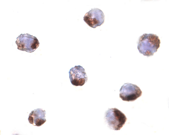 Immunocytochemistry of PHAP in Raji cells with PHAP antibody at 1 μg/mL. Immunocytochemistry of PHAP in Raji cells with PHAP antibody at 1 μg/mL.