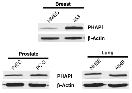 <strong>Figure 8 Overexpression of PHAPI in Breast Cancer Cells (Schafer et al., 2006) </strong><br>
Western blot analysis with anti-PHAPI antibodies was performed for PHAPI in human cell lines from breast, prostate and lung. PHAPI was overexpressed in breast cancer cells when compared with normal cells (HMEC) whereas there were no significant differences in PHAPI expression in normal and cancer cells of either prostate or lung origin. <strong>Figure 8 Overexpression of PHAPI in Breast Cancer Cells (Schafer et al., 2006) </strong><br>
Western blot analysis with anti-PHAPI antibodies was performed for PHAPI in human cell lines from breast, prostate and lung. PHAPI was overexpressed in breast cancer cells when compared with normal cells (HMEC) whereas there were no significant differences in PHAPI expression in normal and cancer cells of either prostate or lung origin.