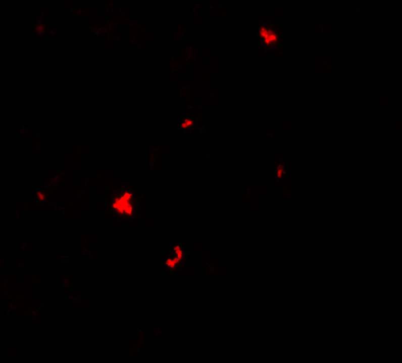 Immunofluorescence of PHLPP1 in SW480 cells with PHLPP1 antibody at 5 μg/ml. Immunofluorescence of PHLPP1 in SW480 cells with PHLPP1 antibody at 5 μg/ml.