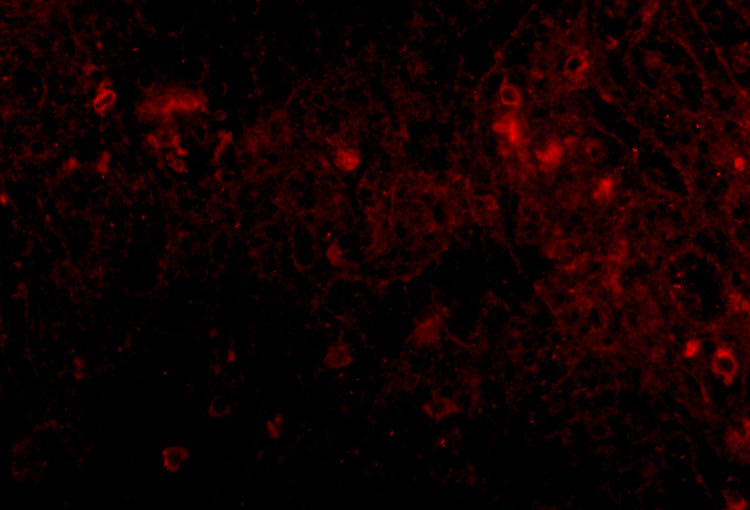 Immunofluorescence of PIGY in human spleen tissue with PIGY1 antibody at 20 μg/mL. Immunofluorescence of PIGY in human spleen tissue with PIGY1 antibody at 20 μg/mL.