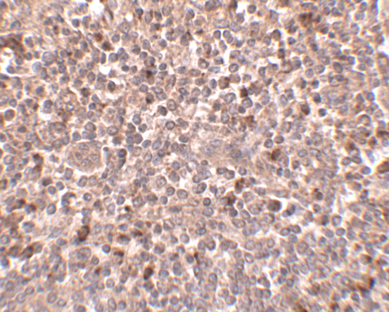 Immunohistochemistry of PIGY in human spleen tissue with PIGY antibody at 2.5 μg/mL. Immunohistochemistry of PIGY in human spleen tissue with PIGY antibody at 2.5 μg/mL.