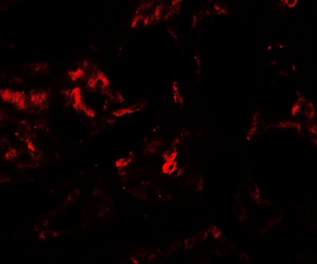 Immunofluorescence of PLA1A in human kidney tissue with PLA1A antibody at 20 μg/mL. Immunofluorescence of PLA1A in human kidney tissue with PLA1A antibody at 20 μg/mL.