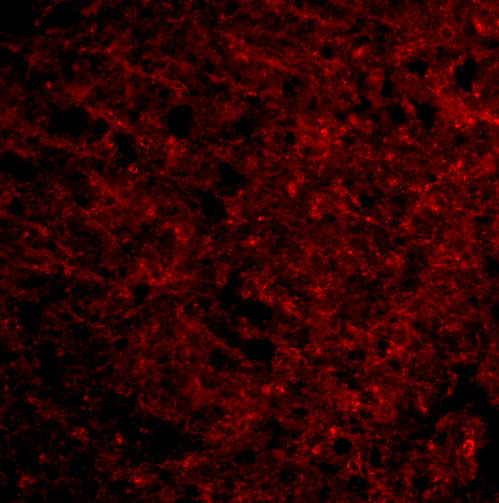 Immunofluorescence of Presenilin1 in Human Brain cells with Presenilin1 antibody at 20 μg/mL. Immunofluorescence of Presenilin1 in Human Brain cells with Presenilin1 antibody at 20 μg/mL.