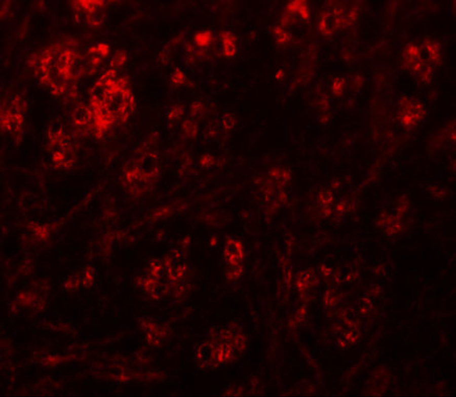 Immunofluorescence of RABEX5 in mouse brain tissue with RABEX5 antibody at 20 μg/mL. Immunofluorescence of RABEX5 in mouse brain tissue with RABEX5 antibody at 20 μg/mL.