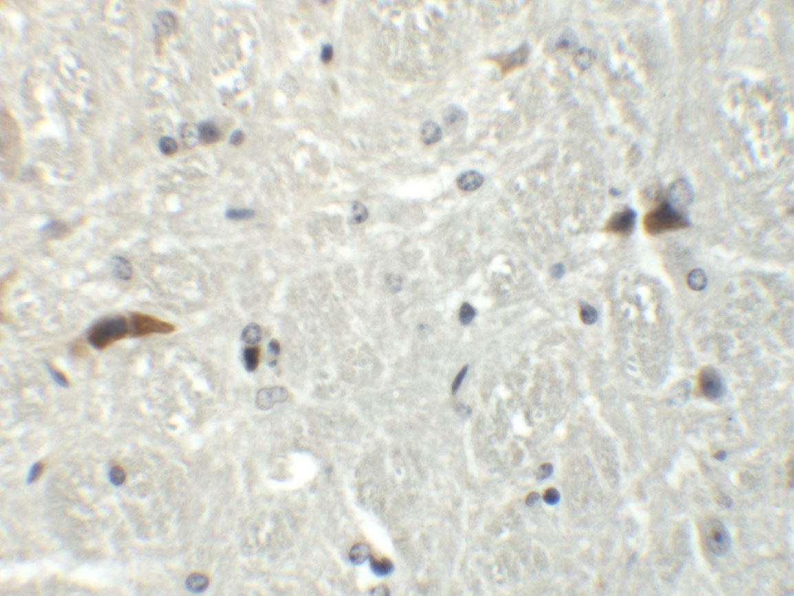 Immunohistochemistry of RABEX5 in mouse brain tissue with RABEX5 antibody at 5 μg/mL. Immunohistochemistry of RABEX5 in mouse brain tissue with RABEX5 antibody at 5 μg/mL.