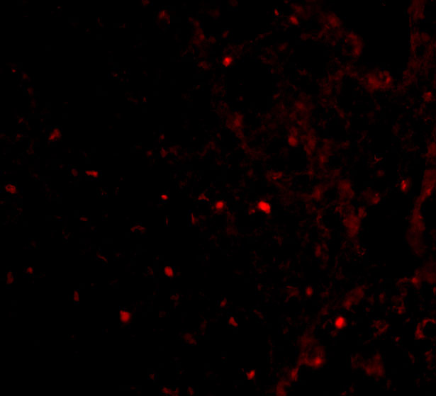 Immunofluorescence of RAP80 in Human Spleen cells with RAP80 antibody at 20 μg/mL. Immunofluorescence of RAP80 in Human Spleen cells with RAP80 antibody at 20 μg/mL.