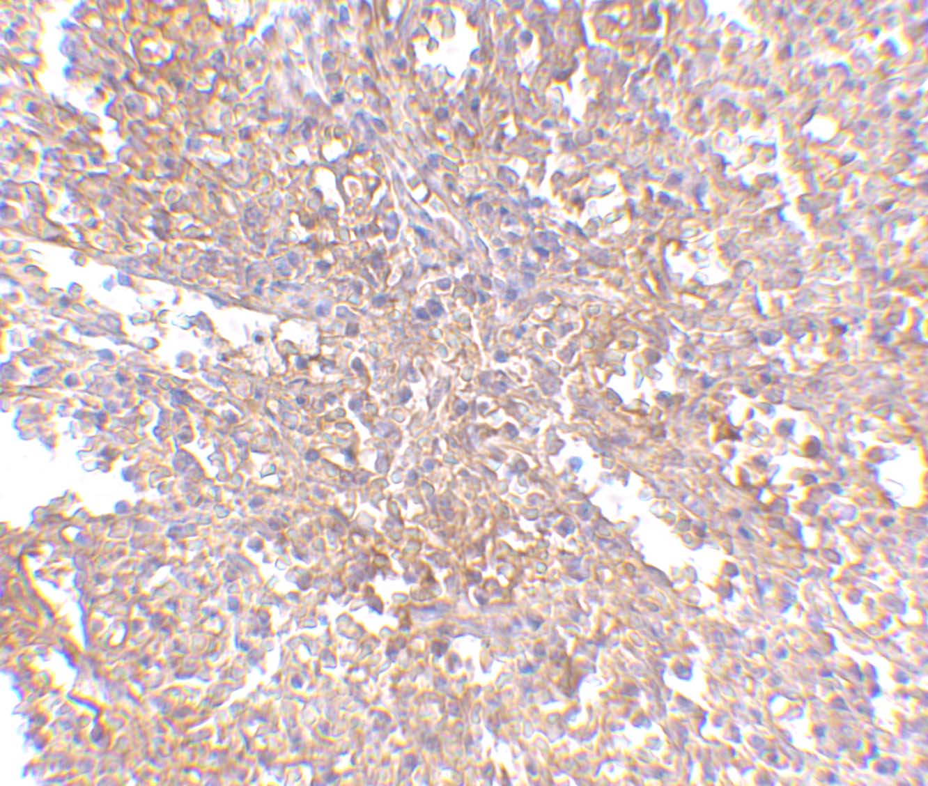 Immunohistochemistry of RAP80 in human spleen tissue with RAP80 antibody at 2.5 μg/mL. Immunohistochemistry of RAP80 in human spleen tissue with RAP80 antibody at 2.5 μg/mL.
