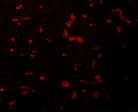 Immunofluorescence of RIPK1 in Mouse Kidney cells with RIPK1 antibody at 20 μg/mL. Immunofluorescence of RIPK1 in Mouse Kidney cells with RIPK1 antibody at 20 μg/mL.