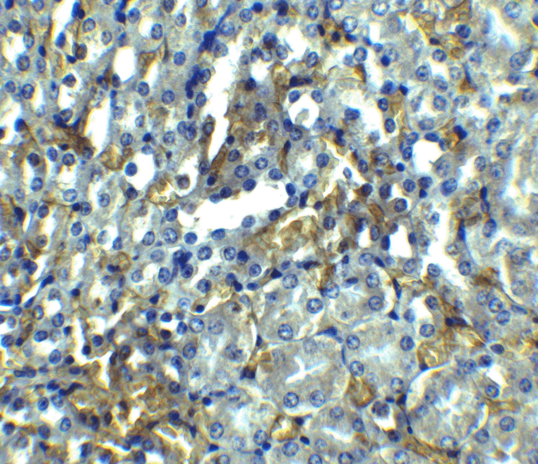 Immunohistochemistry of RIPK1 in mouse kidney tissue with RIPK1 antibody at 2.5 μg/ml. Immunohistochemistry of RIPK1 in mouse kidney tissue with RIPK1 antibody at 2.5 μg/ml.