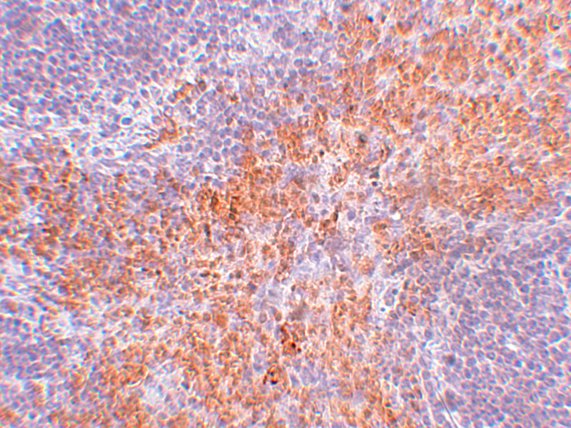 Immunohistochemistry of RIPK1 in mouse kidney tissue with RIPK1 antibody at 2.5 μg/mL. Immunohistochemistry of RIPK1 in mouse kidney tissue with RIPK1 antibody at 2.5 μg/mL.