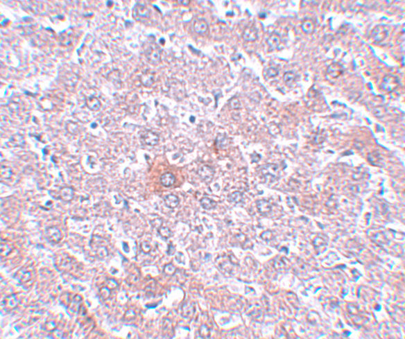 Immunohistochemistry of RSRC1 in rat liver tissue with RSRC1 antibody at 5 μg/mL. Immunohistochemistry of RSRC1 in rat liver tissue with RSRC1 antibody at 5 μg/mL.