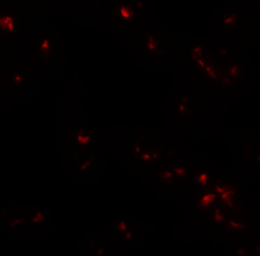 Immunofluorescence of SAE2 in 293 cells with SAE2 antibody at 20 μg/mL. Immunofluorescence of SAE2 in 293 cells with SAE2 antibody at 20 μg/mL.