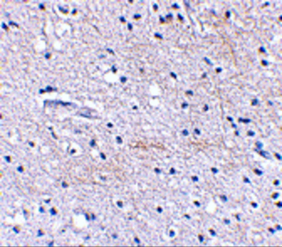 Immunohistochemical staining of human brain tissue using Scrapper antibody at 2.5 μg/mL. Immunohistochemical staining of human brain tissue using Scrapper antibody at 2.5 μg/mL.