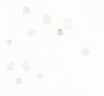 Immunocytochemistry of SEPT1 in Raji cells with SEPT1 antibody at 5 μg/mL. Immunocytochemistry of SEPT1 in Raji cells with SEPT1 antibody at 5 μg/mL.