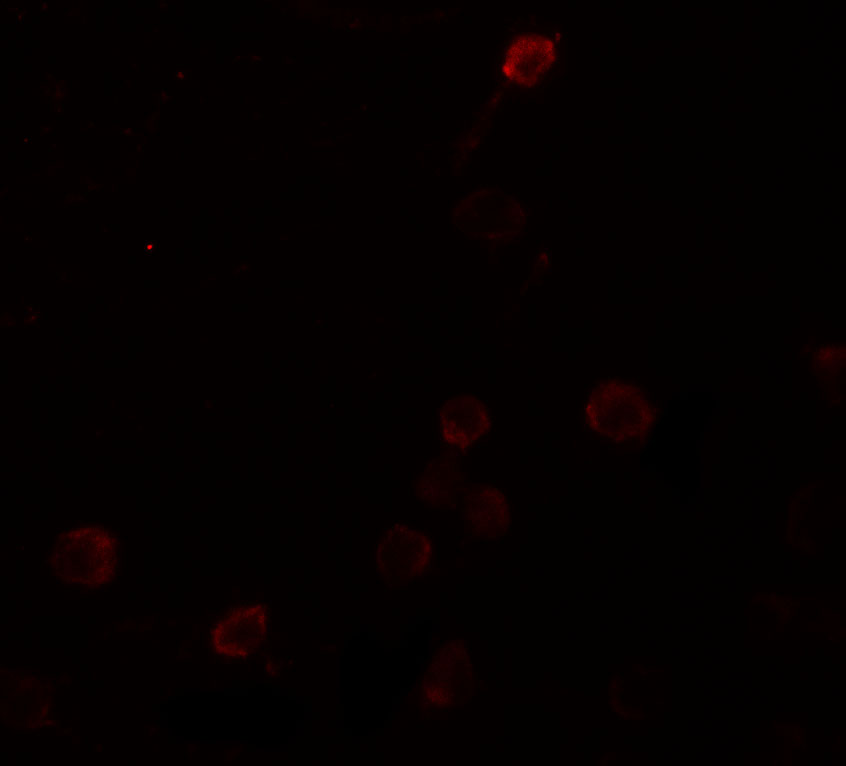 Immunofluorescence of SEPT1 in Raji cells with SEPT1 antibody at 20 μg/mL. Immunofluorescence of SEPT1 in Raji cells with SEPT1 antibody at 20 μg/mL.