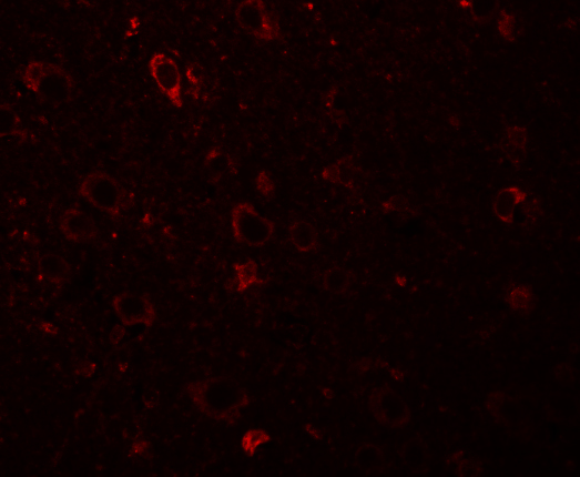 Immunofluorescence of SESTD1 in Human Brain cells with SESTD1 antibody at 20 μg/mL. Immunofluorescence of SESTD1 in Human Brain cells with SESTD1 antibody at 20 μg/mL.