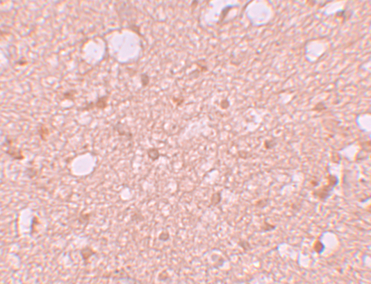 Immunohistochemistry of SESTD1 in human brain tissue with SESTD1 antibody at 5 μg/mL. Immunohistochemistry of SESTD1 in human brain tissue with SESTD1 antibody at 5 μg/mL.