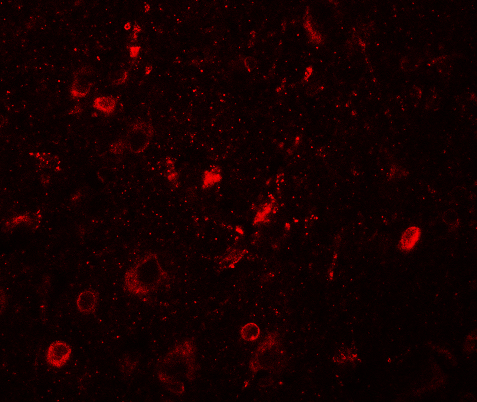 Immunofluorescence of SGSM1 in human brain tissue with SGSM1 antibody at 20 μg/mL. Immunofluorescence of SGSM1 in human brain tissue with SGSM1 antibody at 20 μg/mL.