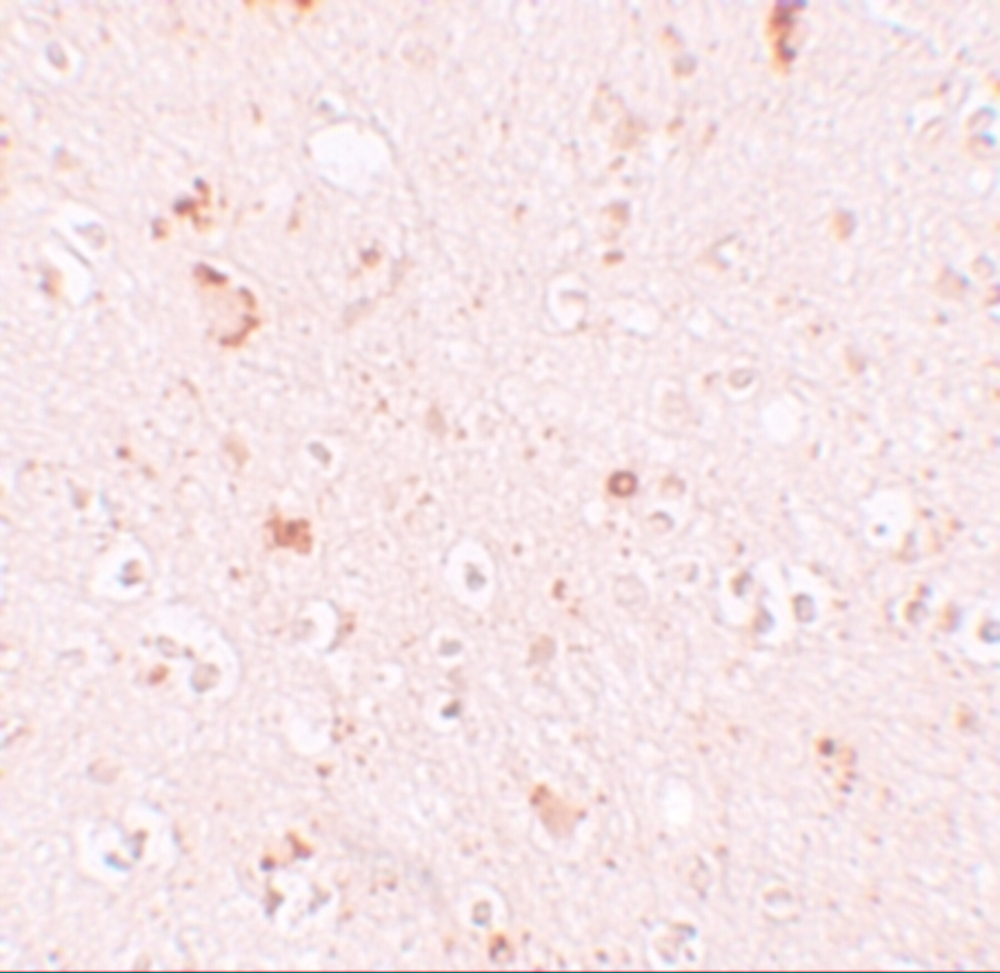 Immunohistochemistry of SH3RF2 in human brain tissue with SH3RF2 antibody at 10 μg/mL.