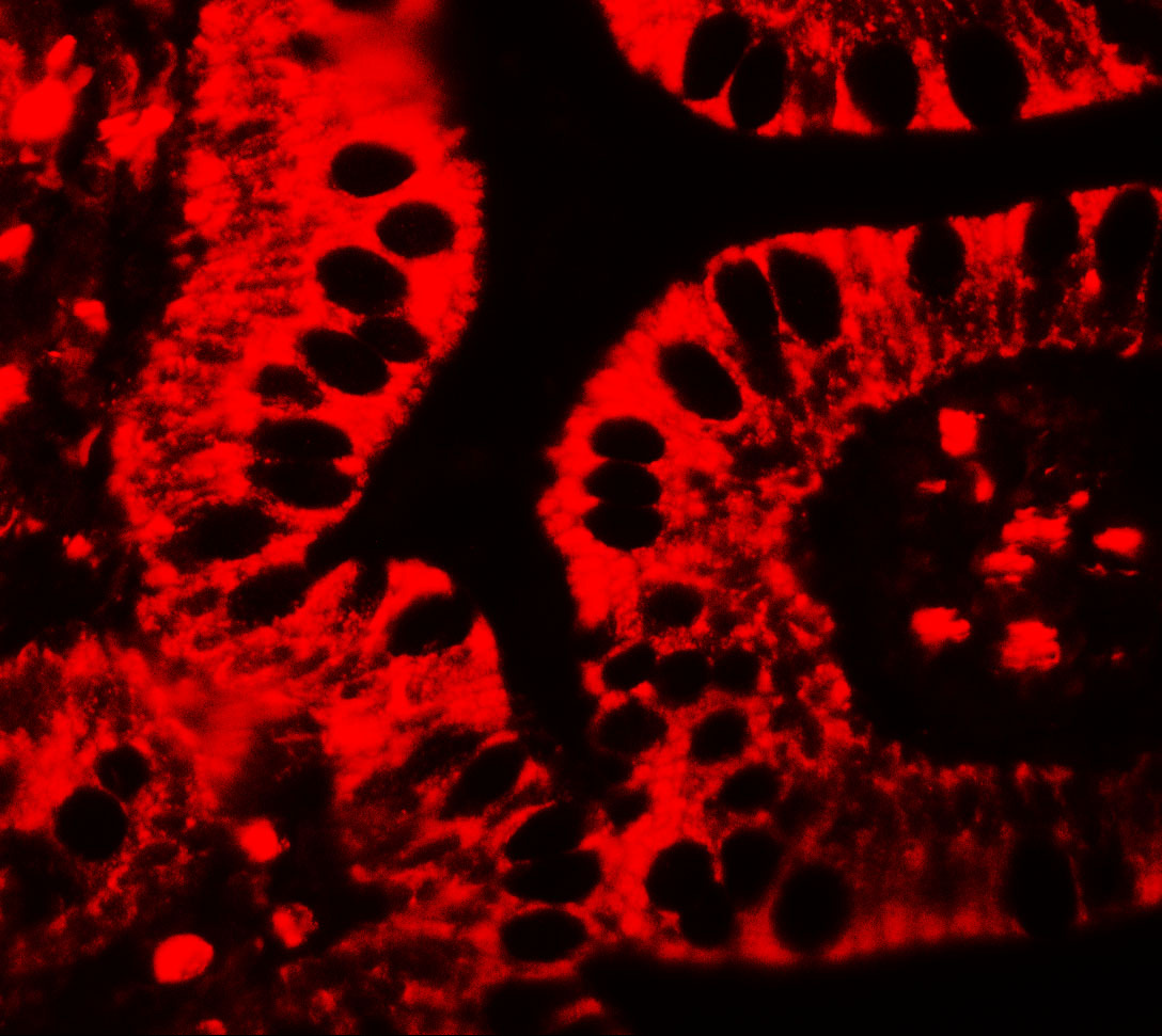 Immunofluorescence of SHISA3 in human small intestine tissue with SHISA3 antibody at 20 μg/ml. Immunofluorescence of SHISA3 in human small intestine tissue with SHISA3 antibody at 20 μg/ml.