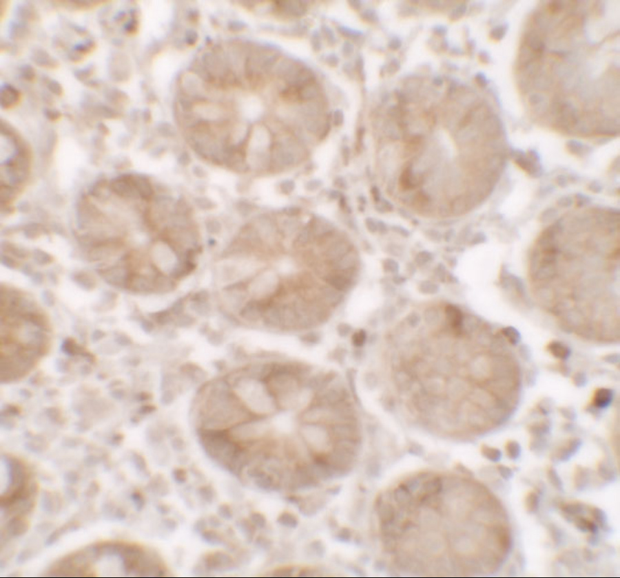 Immunohistochemistry of SHISA3 in human small intestine tissue with SHISA3 antibody at 2.5 μg/ml. Immunohistochemistry of SHISA3 in human small intestine tissue with SHISA3 antibody at 2.5 μg/ml.