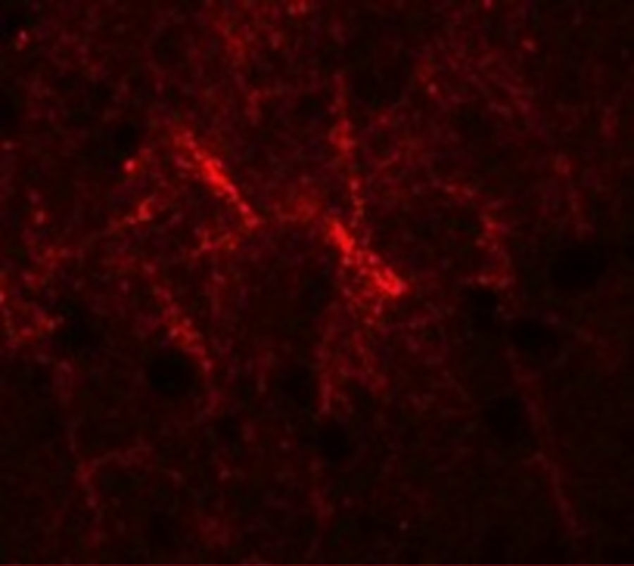 Immunofluorescence of SIPA1 in human brain cells with SIPA1 antibody at 20 μg/mL. Immunofluorescence of SIPA1 in human brain cells with SIPA1 antibody at 20 μg/mL.