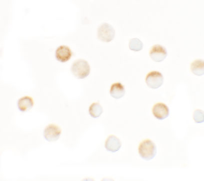 Immunocytochemistry of SLC35D3 in HeLa cells with SLC35D3 antibody at 2.5 μg/mL.