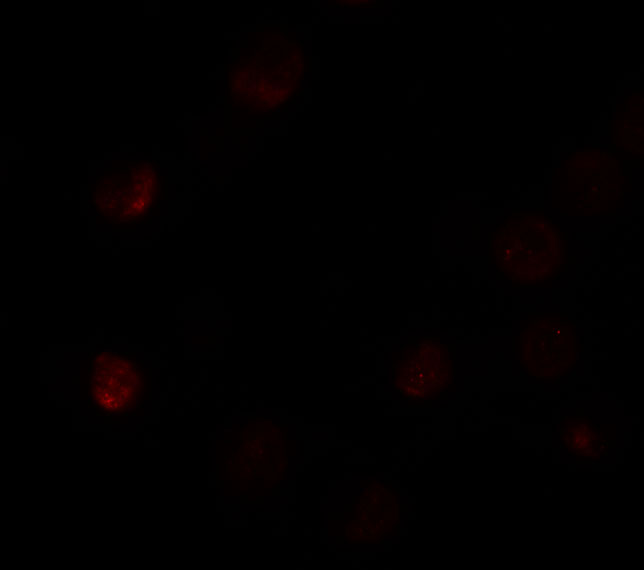 Immunofluorescence of SLC35D3 in HeLa cells with SLC35D3 antibody at 5 μg/mL.