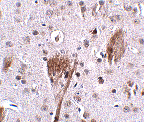 Immunohistochemistry of SPG11 in mouse brain tissue with SPG11 antibody at 2.5 μg/mL.