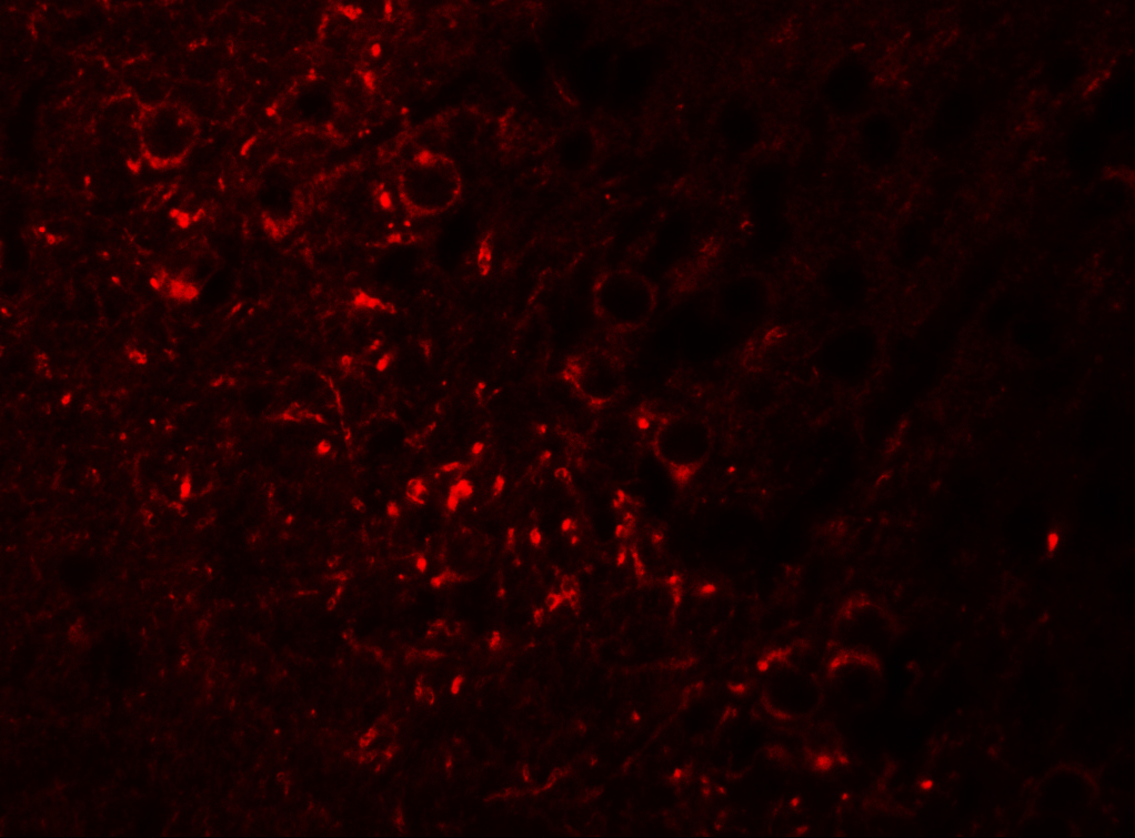 Immunofluorescence of SPRYD5 in mouse brain tissue with SPRYD5 antibody at 20 μg/mL. Immunofluorescence of SPRYD5 in mouse brain tissue with SPRYD5 antibody at 20 μg/mL.