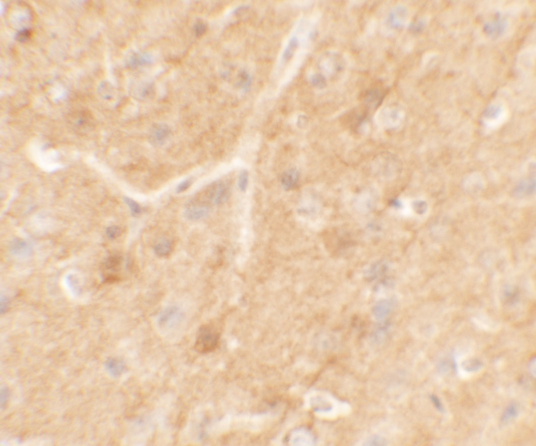 Immunohistochemistry of SPRYD5 in mouse brain tissue with SPRYD5 antibody at 5 μg/mL. Immunohistochemistry of SPRYD5 in mouse brain tissue with SPRYD5 antibody at 5 μg/mL.