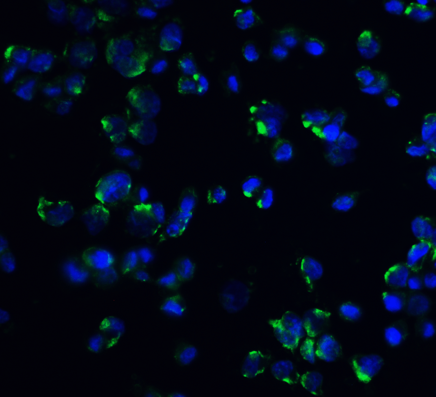 Immunofluorescence of STIM1 in mouse spleen tissue with STIM1 antibody at 20 μg/mL.<br><br>Green: STIM1 Antibody (4119) <br> Blue: DAPI staining Immunofluorescence of STIM1 in mouse spleen tissue with STIM1 antibody at 20 μg/mL.<br><br>Green: STIM1 Antibody (4119) <br> Blue: DAPI staining