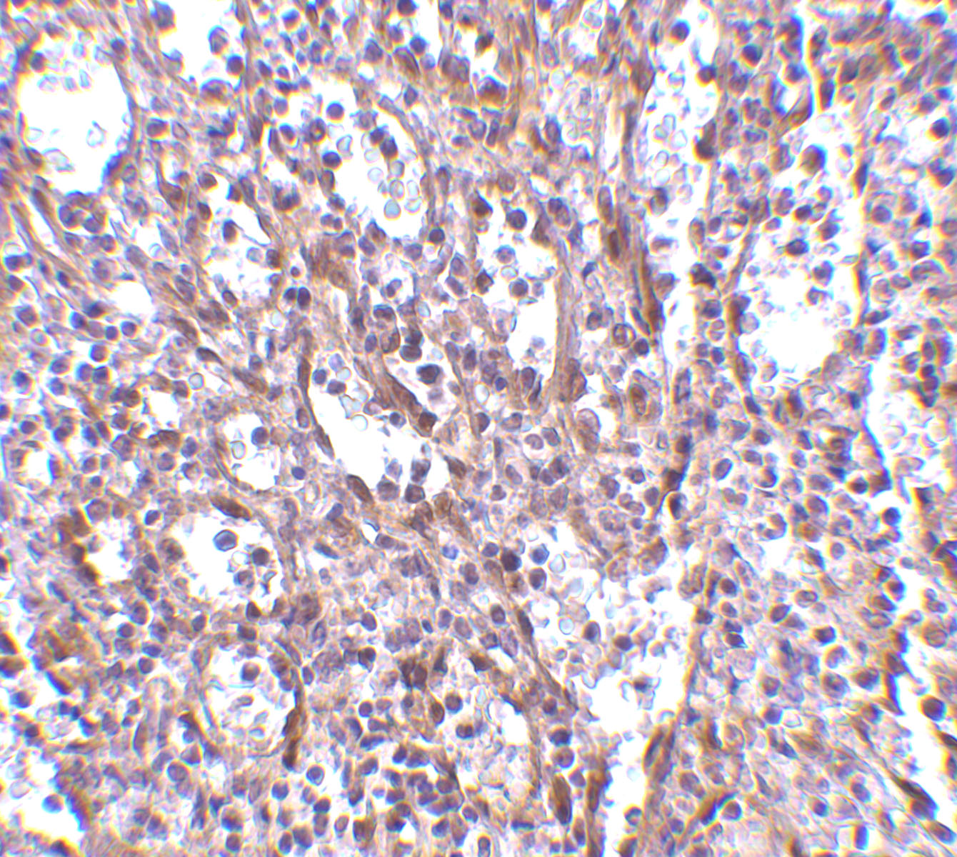 Immunohistochemistry of STIM1 in human spleen tissue with STIM1 antibody at 2.5 μg/mL. Immunohistochemistry of STIM1 in human spleen tissue with STIM1 antibody at 2.5 μg/mL.