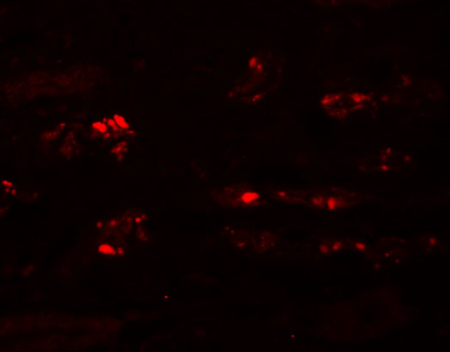 Immunofluorescence of STOX2 in human kidney tissue with STOX2 antibody at 20 μg/mL. Immunofluorescence of STOX2 in human kidney tissue with STOX2 antibody at 20 μg/mL.